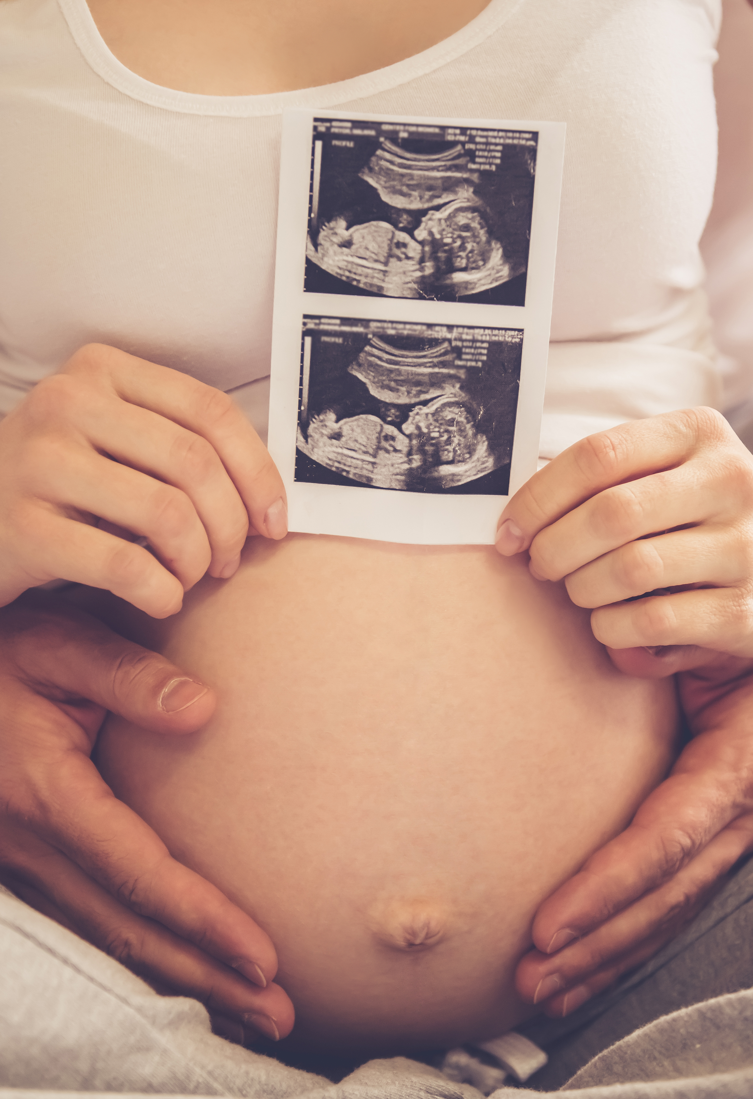 ultrasound_pregnant_shutterstock_529089742